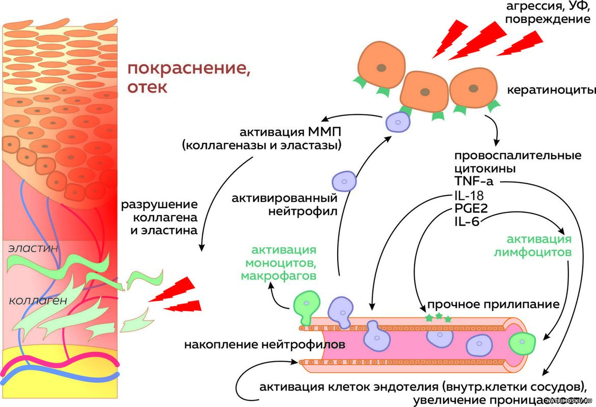 воспаление в кератиноцитах. воспале